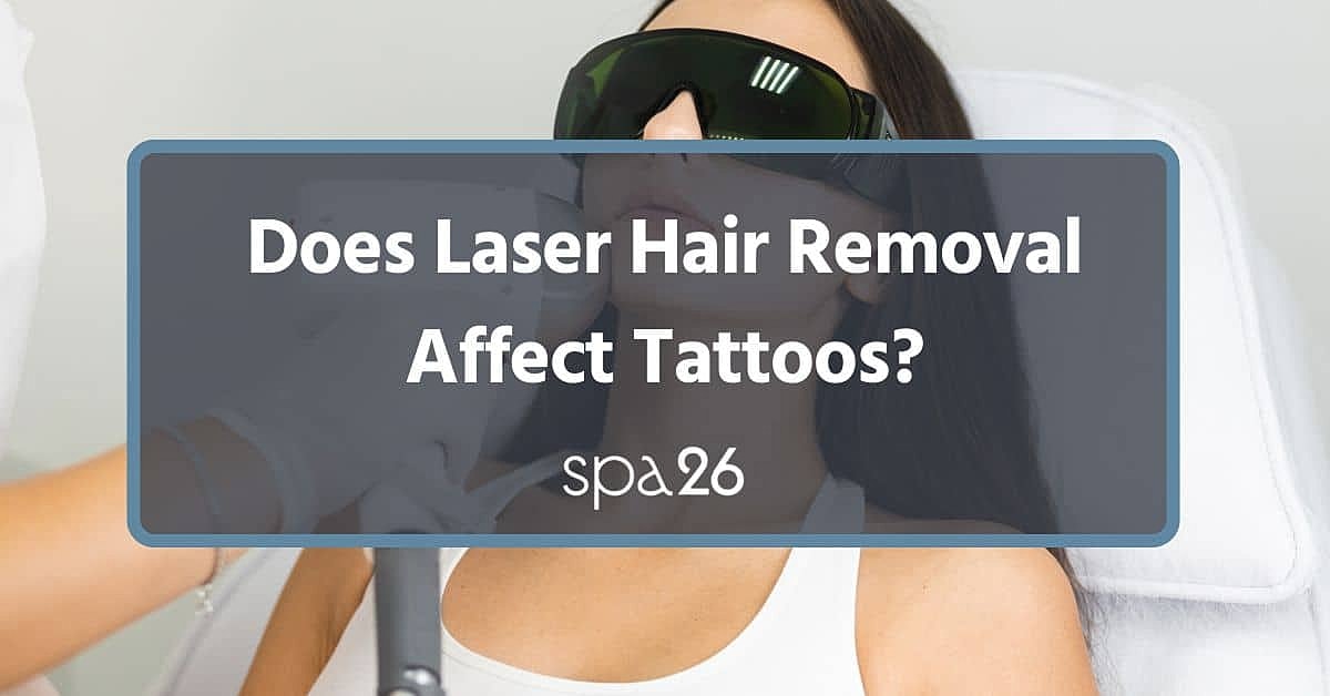 Does Laser Hair Removal Affect Tattoos?