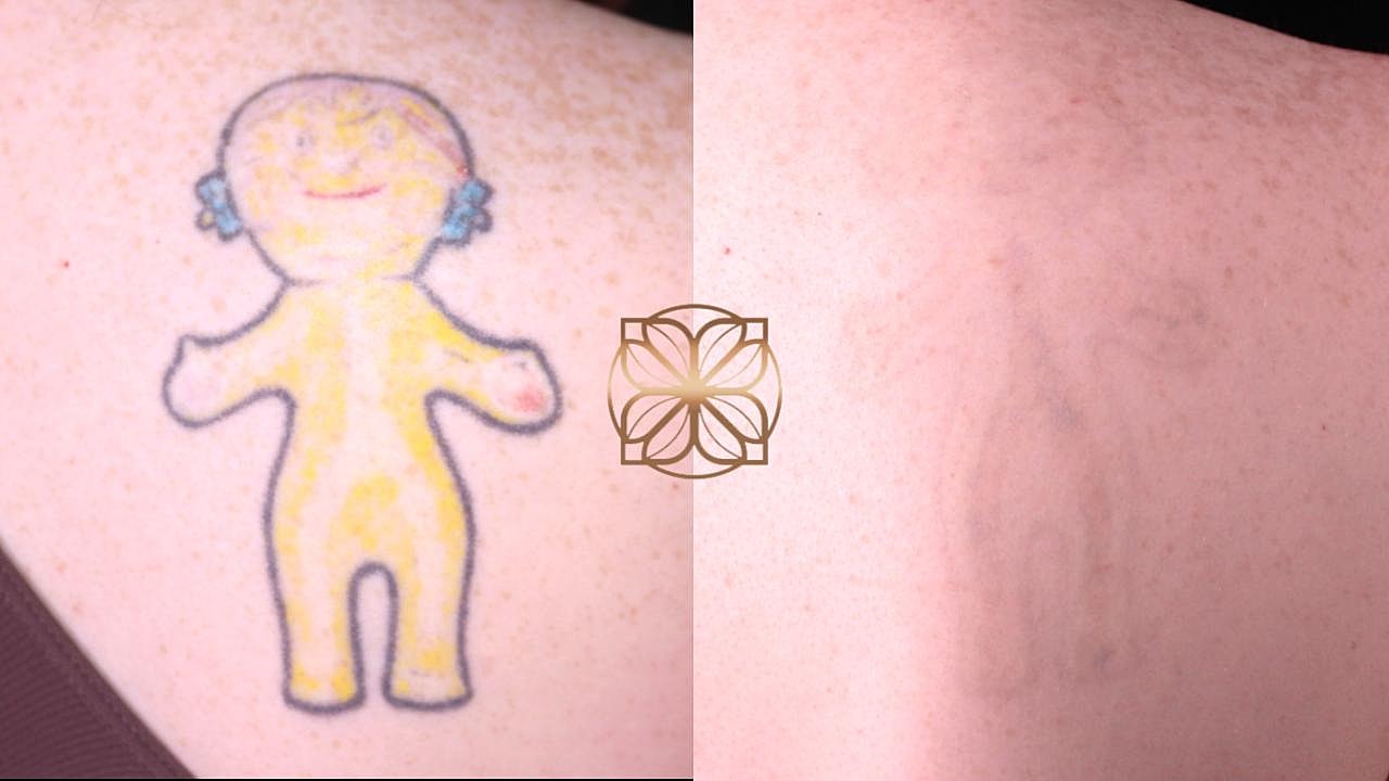 Comparison of colorful tattoo and faded outline.