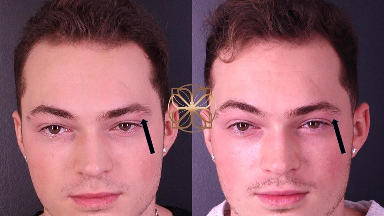 Before and after cosmetic procedure comparison.